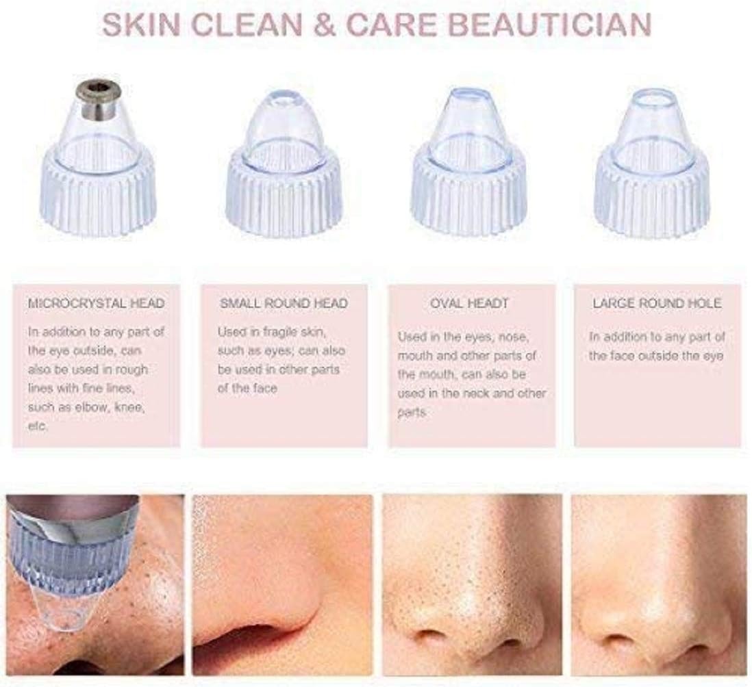 πββοΈ Pore Cleaning Device β¨ | Blackhead Remover Vacuum π USB Rechargeable π